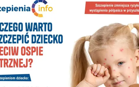 Dziewczynka z ospą wietrzną. Kampania informacyjna o szczepionce na ospę, podkreślająca jej znaczenie dla zdrowia dziecka.