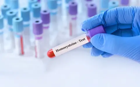 Podwyższona homocysteina: Co oznacza i jak ją skutecznie obniżyć?