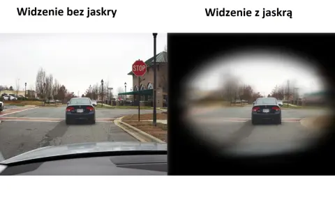 Porównanie widzenia: po lewej - normalne, po prawej - z jaskrą (widoczne ubytki w polu widzenia).