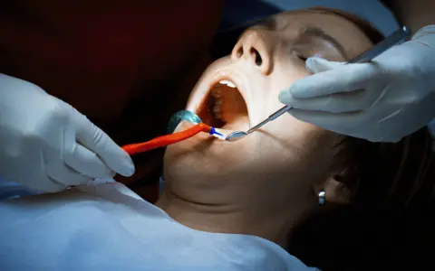 Dentysta bada usta pacjentki, która cierpi na ropień zęba. Widoczne narzędzia stomatologiczne i rozwierak.