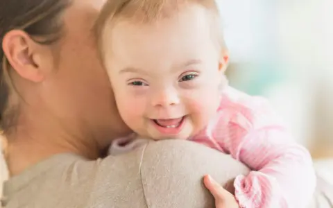 Ein lächelndes, leichtes Down-Syndrom Baby wird von seiner Mutter gehalten.