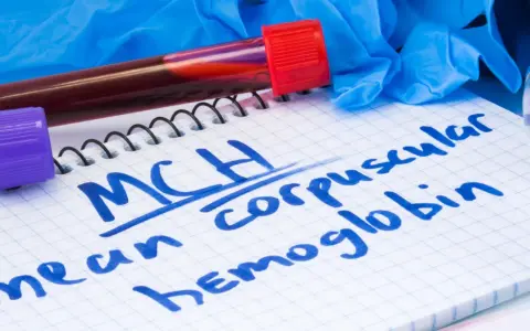Notatnik z zapisanym "MCH mean corpuscular hemoglobin", probówki z krwią, rękawiczki i stetoskop. MCH podwyższone może wskazywać na pewne schorzenia.