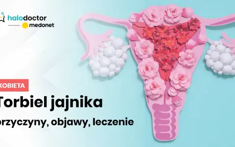 Jakie leki hormonalne na torbiel jajnika mogą skutecznie pomóc?