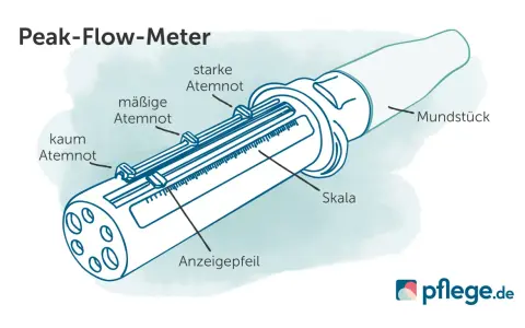 Ein Peak-Flow-Meter mit Skala und Anzeige. Es hilft, Atemnot bei COPD GOLD 3 zu messen.