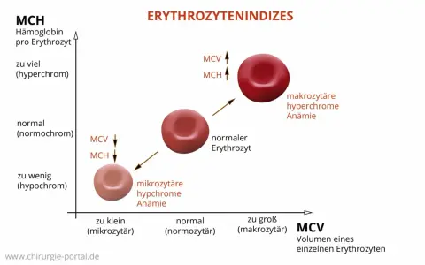 Diagramm zeigt Erythrozytenindizes: MCH (Hämoglobin pro Erythrozyt) und MCV (Volumen). Mikrozytäre, hypochrome Anämie bei niedrigem MCH/MCV. Makrozytäre, hyperchrome Anämie bei hohem MCH/MCV.