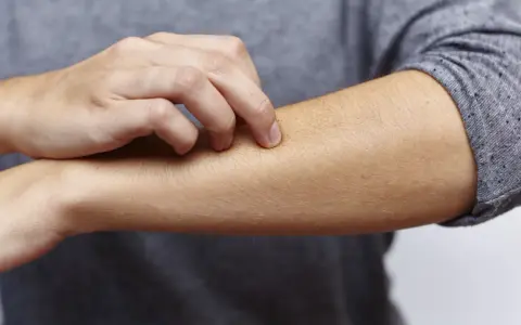 Juckende Haut am Arm, ein mögliches Symptom bei zu viel Zink.
