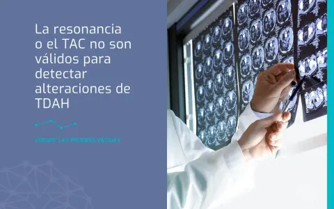 Médico revisa TACs cerebrales. La resonancia o TAC no detectan TDAH. Descubre qué puede estudiar un adolescente con TDAH.