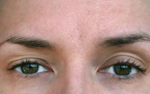Ojos verdes con cejas oscuras y parpados caidos, piel con algunas arrugas finas.