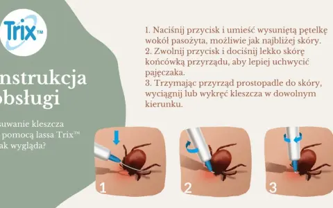 Instrukcja usuwania kleszczy za pomocą przyrządu Trix™. Kleszcze samozaciskowe są łatwe do usunięcia.