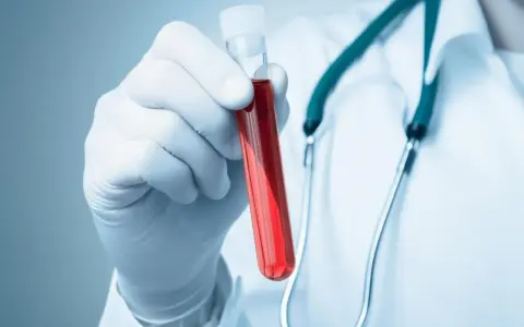 Rękawiczka z pipetą trzyma probówkę z czerwoną cieczą. Lekarz w białym kitlu i zielonym stetoskopie. Co to aptt?