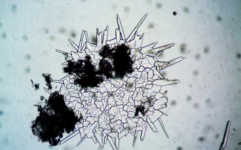 Mikroskopowy obraz pleśni z kryształkami i ciemnymi skupiskami.