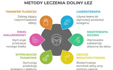 Schemat metod leczenia doliny łez: transfer tłuszczu, kwas hialuronowy, wypełniacze, laseroterapia, mezoterapia igłowa, osocze bogatopłytkowe.