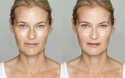 Before and after of a woman's face. The left side shows signs you are aging poorly: wrinkles, sun spots, and uneven skin tone. The right side shows a smoother, brighter complexion.