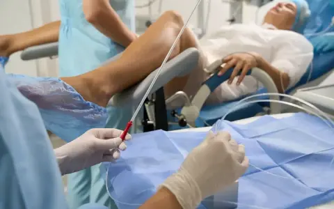 Person w rękawiczkach przygotowuje się do procedury, która może pomóc w oddawaniu moczu po wyjęciu cewnika. Pacjentka leży na łóżku.