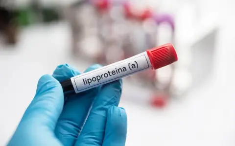 Ręka w niebieskiej rękawiczce trzyma probówkę z etykietą "lipoproteina (a)". Badanie poziomu tej lipoproteiny jest ważne.