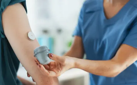 Lekarz od chorób metabolicznych pomaga pacjentowi z glukometrem na ramieniu.