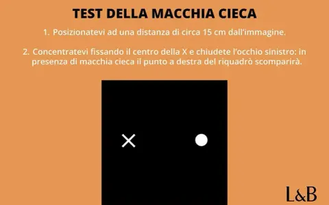 Test della macchia cieca: fissa la X, chiudi l'occhio sinistro. Il punto a destra del riquadro nero potrebbe scomparire, come se fosse vedere ombrato da un occhio.