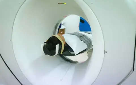 Czy lekarz rehabilitacji może wystawić skierowanie na rezonans? Sprawdź!