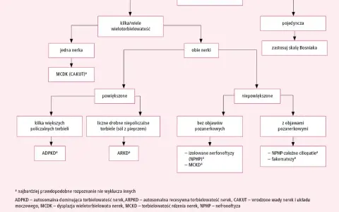 Schemat diagnostyczny torbieli nerek: od pojedynczej torbieli do wielotorbielowatości, uwzględniający objawy i skalę Bosniaka.