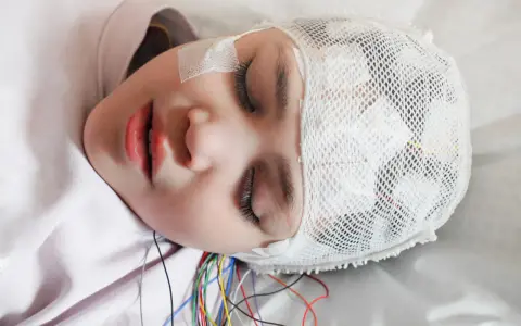 Padaczka skroniowa: objawy psychiczne, które mogą zaskoczyć każdego