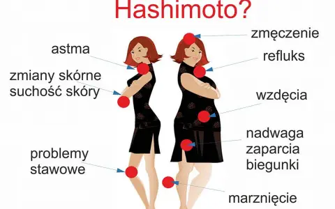 Hashimoto objawy psychiczne - jak rozpoznać i zrozumieć ich wpływ