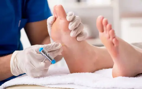 Badanie neurologiczne stopy, sprawdzanie odruchu Babińskiego za pomocą młoteczka.