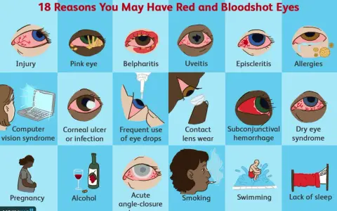 Molte cause possono portare a un occhio sempre rosso: dall'allergia all'uso di lenti a contatto, fino alla stanchezza.