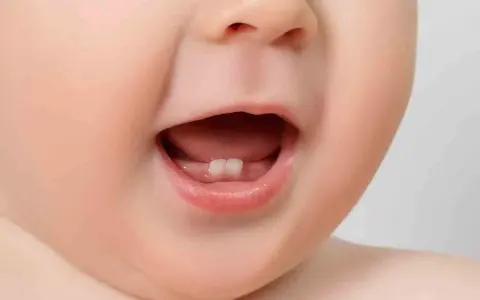 Malutkie ząbki dziecka, pierwsze oznaki ząbkowania kiedy.