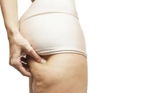 Jak skutecznie walczyć z cellulitem? Poradnik eksperta