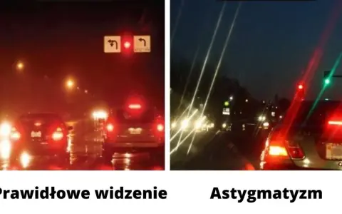 Astygmatyzm: Jak widzi świat astygmatyk? Zrozum niezborność oka
