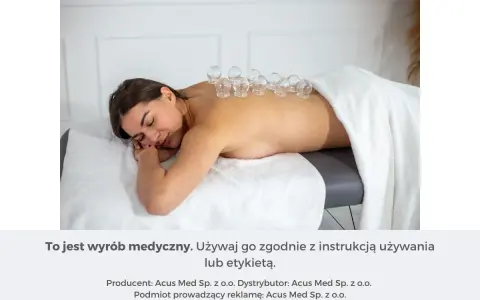 Kobieta leży na plecach, na jej kręgosłupie umieszczono szklane bańki na plecy.