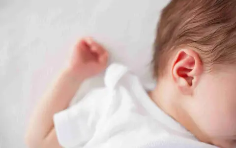 Un neonato dorme troppo, con la testolina appoggiata su un morbido lettino bianco. Si intravede un orecchio rosa e una manina.