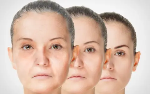 Trois visages de femmes montrant le processus de régénération de la peau, du plus âgé au plus jeune.