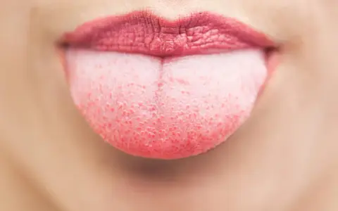 Nahaufnahme einer Zunge mit einem leichten, rosafarbenen belag auf der zunge. Die Lippen sind leicht geöffnet.