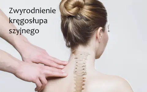Domowe sposoby na zwyrodnienie kręgosłupa szyjnego: delikatny masaż karku i ćwiczenia rozluźniające.