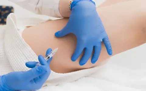 Zabieg lipolizy iniekcyjnej. Dłoń w niebieskiej rękawiczce wykonuje zastrzyk w udo. Możliwe lipoliza iniekcyjna efekty uboczne.