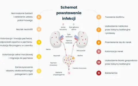 Schemat powstawania infekcji, prowadzącej do nawracającego zapalenia pęcherza. Ukazuje drogę bakterii od jelit do nerek.