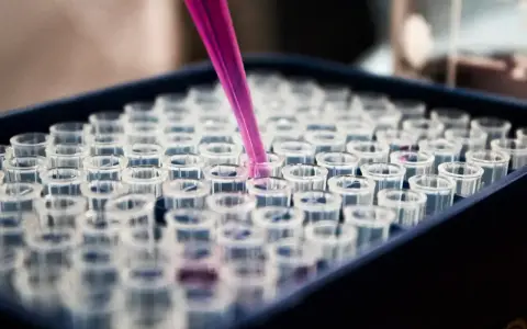 Różowa pipeta dodaje płyn do probówek w laboratorium. To kluczowy etap w badaniu histopatologicznym, który pozwala na analizę próbek.
