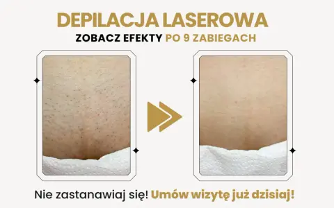 Depilacja laserowa bikini przed i po: widoczna redukcja owłosienia po 9 zabiegach. Gładka skóra bez podrażnień.