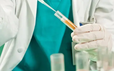 Badacz w białym fartuchu i rękawiczkach pobiera próbkę płynu do probówki. Badanie może pomóc ustalić, jak zahamować krwiomocz.