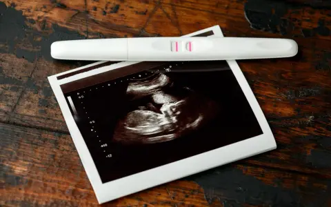 USG 7 tydzień ciąży pokazuje zarodek. Obok leży pozytywny test ciążowy.
