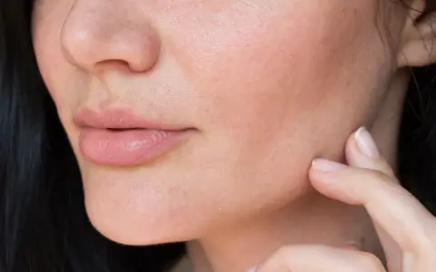 Dita che accarezzano il viso, mostrando come idratare la pelle del viso molto secca per un aspetto radioso e morbido.