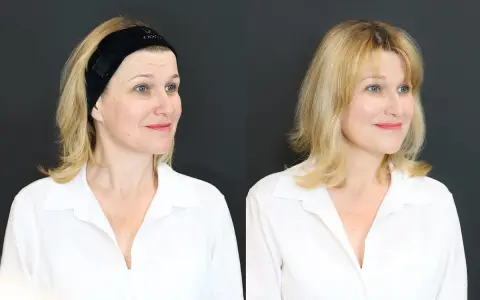 Kobieta przed i po użyciu stymulatora Karisma. Opinia: skóra wygląda na bardziej nawilżoną i promienną.