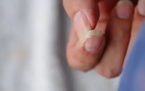 Un ongle se casse, une question se pose : pourquoi mes ongles se cassent ? Gros plan sur un ongle abîmé.
