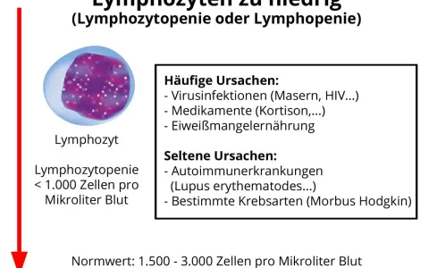 Bild zeigt einen Lymphozyten und erklärt, dass zu niedrige Lymphozyten (Lymphozytopenie) durch Viren, Medikamente oder Mangelernährung verursacht werden können.