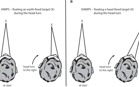 Il test **head impulse test** confronta la fissazione di un bersaglio fisso (A) con quella di un bersaglio mobile con la testa (B) durante una rotazione.