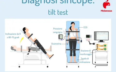 Test tilt per la diagnosi di sincope. Monitoraggio ECG, pressione e ossimetria. Simula la sensazione di svenire ma non svengo, ansia.
