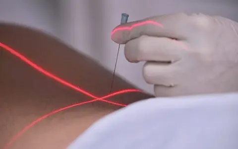 Eine Hand in einem Handschuh führt eine prt spritze unter rotem Laserlicht.