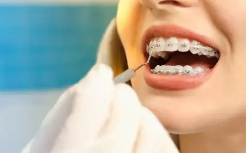 Uśmiech z aparatem na dolne zęby. Dentysta sprawdza zęby pacjentki.