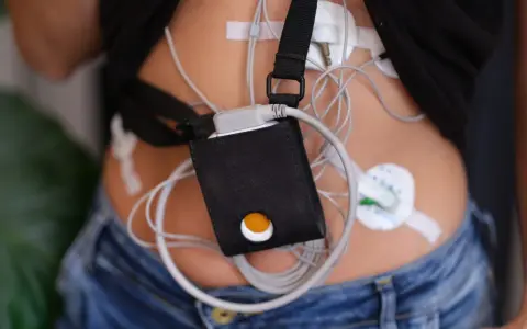 Urządzenie holter monitoruje pracę serca. To małe, przenośne urządzenie z elektrodami przyczepionymi do skóry.